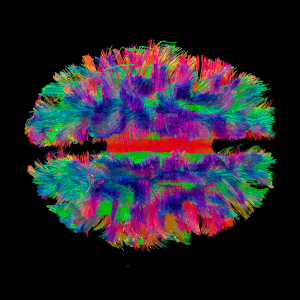 Mint labs brain scan